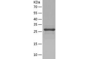 Western Blotting (WB) image for AU RNA Binding Protein/enoyl-CoA Hydratase (AUH) (AA 68-339) protein (His tag) (ABIN7121948) (AUH Protein (AA 68-339) (His tag))