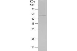 Western Blotting (WB) image for Interleukin 11 Receptor, alpha (IL11RA) (AA 145-362) protein (His-IF2DI Tag) (ABIN7123544)