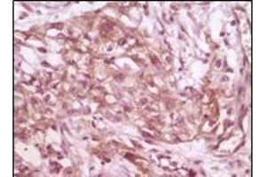 Immunohistochemistry (IHC) image for anti-Eukaryotic Translation Initiation Factor 4E Binding Protein 1 (EIF4EBP1) (truncated) antibody (ABIN2464007)