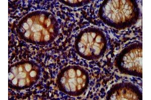 IHC image of ABIN7167024 diluted at 1:700 and staining in paraffin-embedded human appendix tissue performed on a Leica BondTM system. (AKT1 anticorps  (AA 1-480))