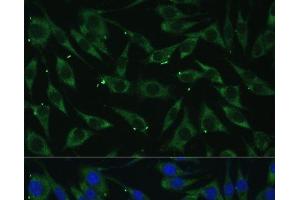 Immunofluorescence analysis of L929 cells using DICER1 Polyclonal Antibody at dilution of 1:100 (40x lens). (DICER1 anticorps)