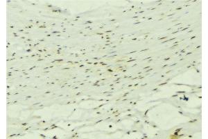 ABIN6272619 at 1/100 staining Mouse muscle tissue by IHC-P. (KALRN anticorps  (C-Term))
