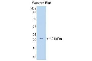 Detection of Recombinant TNFa, Rat using Polyclonal Antibody to Tumor Necrosis Factor Alpha (TNFa) (TNF alpha anticorps  (AA 80-235))