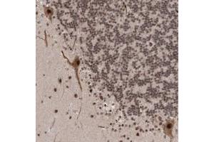 Immunohistochemical staining of human cerebellum with ZNF592 polyclonal antibody  shows strong nuclear positivity in purkinje cells at 1:10-1:20 dilution.