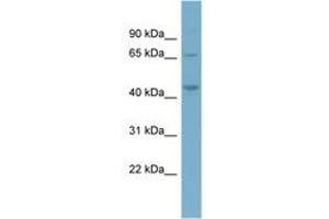 Image no. 1 for anti-Phosphatidylinositol-5-Phosphate 4-Kinase, Type II, alpha (PIP4K2A) (AA 287-336) antibody (ABIN6741987) (PIP4K2A anticorps  (AA 287-336))