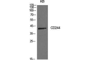 Western Blotting (WB) image for anti-Natural Killer Cell Receptor 2B4 (CD244) antibody (ABIN5959144) (2B4 anticorps)