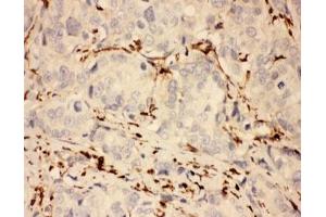 IHC-P testing of human breast cancer tissue