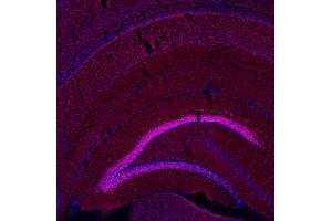 Indirect immunostaining of a PFA fixed mouse brain section (dilution 1 : 500; red). (BCL11B anticorps  (AA 1-151))