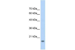 WB Suggested Anti-AMFR Antibody Titration:  2. (AMFR anticorps  (C-Term))