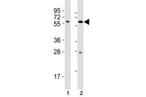 Western blot testing of SOX10 antibody at 1:2000 dilution.