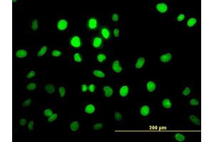 Immunofluorescence of monoclonal antibody to PBX2 on HeLa cell.