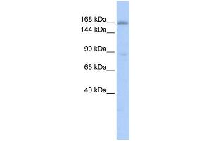 WB Suggested Anti-PBRM1 Antibody Titration: 0. (Polybromo 1 anticorps  (Middle Region))