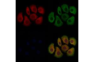 ABIN7094011 and ABIN7098055 staining Hela cells by IF/ICC.
