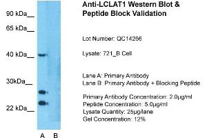 Host: Rabbit  Target Name: LCLAT1  Sample Tissue: Human 721_B cell  Lane A:  Primary Antibody Lane B:  Primary Antibody + Blocking Peptide Primary Antibody Concentration: 1 µg/mL Peptide Concentration: 5.