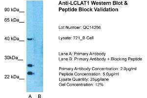 Host: Rabbit  Target Name: LCLAT1  Sample Tissue: Human 721_B cell  Lane A:  Primary Antibody Lane B:  Primary Antibody + Blocking Peptide Primary Antibody Concentration: 1 µg/mL Peptide Concentration: 5. (LCLAT1 anticorps  (Middle Region))