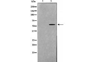 Western blot analysis on mouse brain cell lysate using DOK7 Antibody，The lane on the left is treated with the antigen-specific peptide. (DOK7 anticorps  (C-Term))