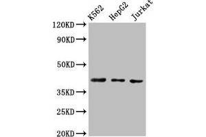 Western Blot Positive WB detected in: K562 whole cell lysate, HepG2 whole cell lysate, Jurkat whole cell lysate All lanes: CXCR3 antibody at 3 μg/mL Secondary Goat polyclonal to rabbit IgG at 1/50000 dilution Predicted band size: 41, 46, 29 kDa Observed band size: 41 kDa (CXCR3 anticorps  (AA 4-50))