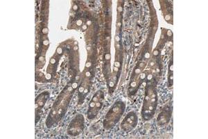 Immunohistochemical staining of human duodenum shows moderate cytoplasmic positivity in glandular cells.