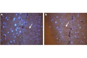 Expression of CNG3 in rat brain - Immunohistochemical staining of frozen rat hippocampal dentate gyrus (DG) sections using Anti-CNGA3 Antibody (ABIN7043091 and ABIN7044975).