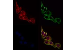 ABIN6257040 and ABIN6275770 staining HepG2 cells by IF/ICC. (IL13RA2 anticorps  (C-Term))