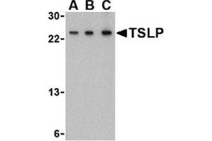Western blot analysis of TSLP in A-20 cell lysate with this product at (A) 0. (Thymic Stromal Lymphopoietin anticorps  (Center))