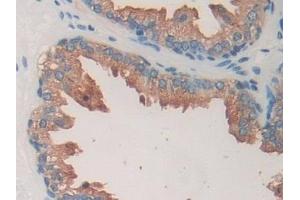 Detection of TOR1A in Human Prostate Tissue using Polyclonal Antibody to Torsin 1A (TOR1A)
