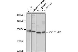 Western blot analysis of extracts of various cell lines, using ASC/TMS1 Rabbit pAb (ABIN7269756) at 1:3000 dilution. (PYCARD anticorps)