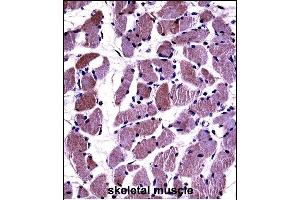 DAG1 Antibody (C-term) ((ABIN658022 and ABIN2846960))immunohistochemistry analysis in formalin fixed and paraffin embedded human skeletal muscle followed by peroxidase conjugation of the secondary antibody and DAB staining.