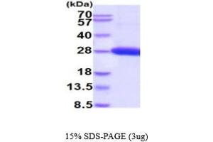 SDS-PAGE (SDS) image for UL16 Binding Protein 1 (ULBP1) (AA 26-216) protein (His tag) (ABIN6387928)