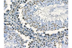 ABIN7095242 and ABIN7099299 at 1/100 staining rat testis tissue by IHC-P. (RNF43 anticorps)