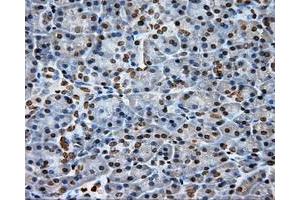 Immunohistochemical staining of paraffin-embedded Kidney tissue using anti-DAPK2 mouse monoclonal antibody. (DAPK2 anticorps)