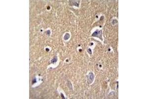 Immunohistochemistry analysis in formalin fixed and paraffin embedded human brain tissue reacted with FBXO21 Antibody (C-term) followed by peroxidase conjugation of the secondary antibody and DAB staining.