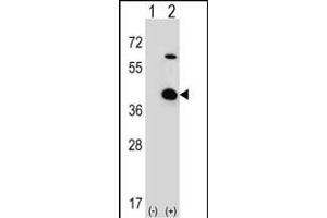 Western blot analysis of STR (arrow) using rabbit polyclonal STR Antibody (C-term) 2933b. (STRAP anticorps  (C-Term))