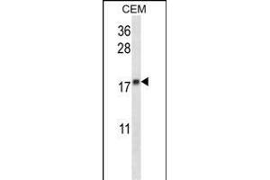 MGMT Antibody (N-term) (ABIN657769 and ABIN2846745) western blot analysis in CEM cell line lysates (35 μg/lane). (MGMT anticorps  (N-Term))