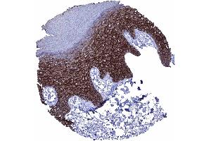 Squamous epithelium of the skin showing a strong membranous desmoglein 1 immunostaining