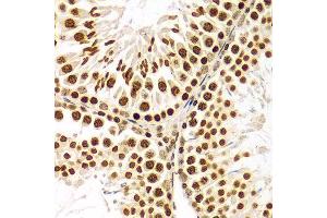 Immunohistochemistry of paraffin-embedded Rat testis using Histone H3 antibody at dilution of 1:100 (x400 lens). (Histone 3 anticorps  (C-Term))