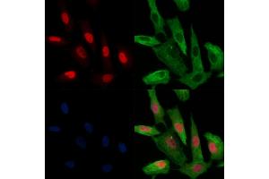 ABIN6256313 and ABIN6267679 staining  cells(H2O2 treatment) by IF/ICC.