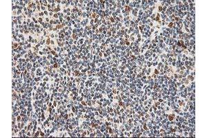 Image no. 11 for anti-Excision Repair Cross-Complementing Rodent Repair Deficiency, Complementation Group 4 (ERCC4) antibody (ABIN1498070)