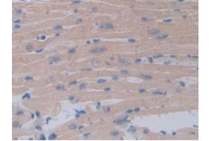 IHC-P analysis of Mouse Heart Tissue, with DAB staining. (Occludin anticorps  (AA 17-107))