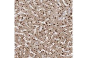Immunohistochemical staining of human liver with AOF1 polyclonal antibody  shows nuclear and cytoplasmic positivity in hepatocytes. (KDM1B anticorps)
