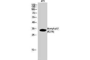 Western Blotting (WB) image for anti-P57 (acLys278) antibody (ABIN3181900) (P57 (acLys278) anticorps)