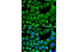 Immunofluorescence analysis of HeLa cells using BCL2L11 antibody. (BIM anticorps)