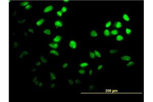 Immunofluorescence of monoclonal antibody to FOXF2 on HeLa cell.