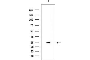 anti-Protein Tyrosine Phosphatase, Mitochondrial 1 (PTPMT1) antibody