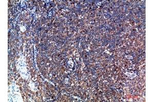 Immunohistochemical analysis of paraffin-embedded human-tonsil, antibody was diluted at 1:200