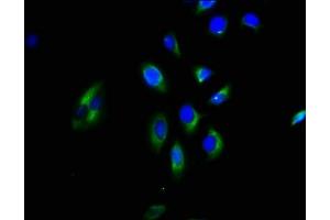 Immunofluorescence staining of A549 cells with ABIN7154684 at 1:200, counter-stained with DAPI.