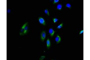 Immunofluorescence staining of A549 cells with ABIN7154684 at 1:200, counter-stained with DAPI. (GNGT2 anticorps  (AA 1-66))