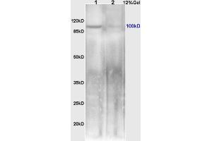 L1 mouse small intestine lysates L2 rat brain lysates probed with Anti NFkB Inducing Kinase NIK Polyclonal Antibody, Unconjugated (ABIN724520) at 1:200 overnight at 4 °C.