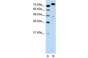 WB Suggested Anti-MCM3  Antibody Titration: 0. (MCM3 anticorps  (C-Term))