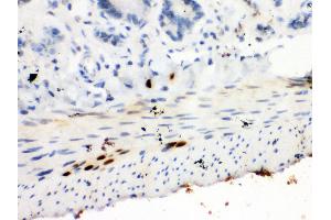Anti-STAT6 antibody, IHC(P) IHC(P): Rat Intestine Tissue
